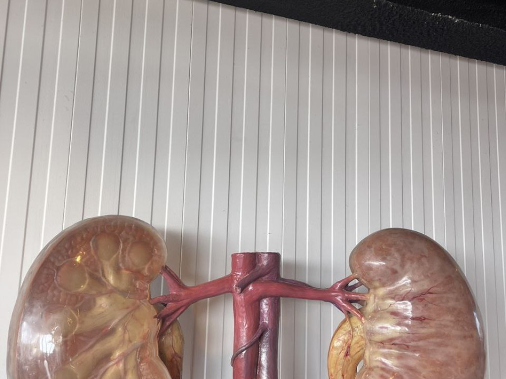 Екскурсія в Амстердамі - Corpus Museum (Угстгест)