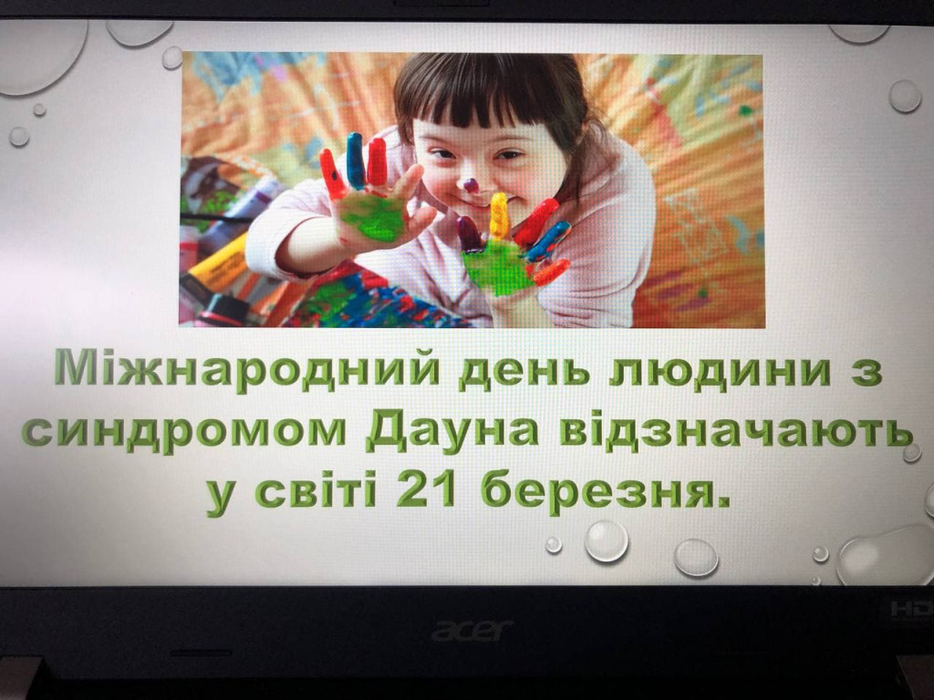 Міжнародний день людини з синдромом Дауна.